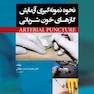 نحوه نمونه گیری آزمایش گازهای خون شریانی ARTERIAL PUNCTURE