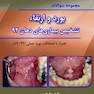 BDQ مجموعه سوالات تفکیکی بورد و ارتقاء تشخیص بیماری های دهان 92