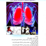اصول طب کار (بیماری های دستگاه تنفسی ناشی از کار )