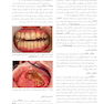 بیماری های دهان (دهان پزشکی) برکت 2021 جلد اول