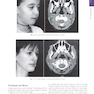 Cosmetic Facial Surgery 2nd Edicion