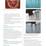 Clinical Cases in Implant Dentistry