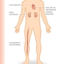 Essential Human Disease for Dentists 