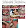 Lasers in Dentistry-Current Concepts