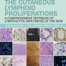 The Cutaneous Lymphoid Proliferations: A Comprehensive Textbook of Lymphocytic Infiltrates of the Skin 2nd Edition, Kindle Edition