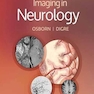 Imaging in Neurology