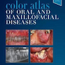 Color Atlas of Oral and Maxillofacial Diseases