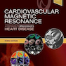 Cardiovascular Magnetic Resonance : A Companion to Braunwald