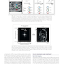 Cardiovascular Magnetic Resonance : A Companion to Braunwald