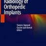 Radiology of Orthopedic Implants