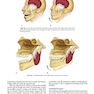 Management of Temporomandibular Disorders and Occlusion 2020