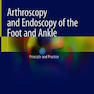 Arthroscopy and Endoscopy of the Foot and Ankle : Principle and Practice