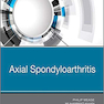 Axial Spondyloarthritis