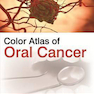 Color Atlas of Oral Cancer