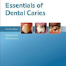 Essentials of Dental Caries
