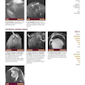  تصویربرداری عضلانی و اسکلتی اسکلت Musculoskeletal Imaging Cases 