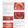 Diseases and Conditions in Dentistry: An Evidence-Based Reference 1st Edition 2018  بیماریها و شرایط در دندانپزشکی: یک مرجع مبتنی بر شواهد