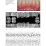  Advances in Periodontal Surgery: A Clinical Guide to Techniques and Interdisciplinary Approaches 1st ed. 2020 Edition پیشرفت در جراحی پریودنتال: راهنمای بالینی تکنیک ها و رویکردهای بین رشته ای