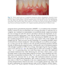  Advances in Periodontal Surgery: A Clinical Guide to Techniques and Interdisciplinary Approaches 1st ed. 2020 Edition پیشرفت در جراحی پریودنتال: راهنمای بالینی تکنیک ها و رویکردهای بین رشته ای