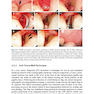  Advances in Periodontal Surgery: A Clinical Guide to Techniques and Interdisciplinary Approaches 1st ed. 2020 Edition پیشرفت در جراحی پریودنتال: راهنمای بالینی تکنیک ها و رویکردهای بین رشته ای