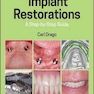  Implant Restorations: A Step-by-Step Guide 4th Edition, Kindle Edition 2020 ترمیم ایمپلنت: راهنمای گام به گام