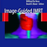 Image-Guided IMRT 1st Edition