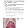 Pocketbook of Oral Disease 2012