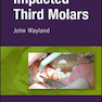 2018 Impacted Third Molars 1st Edition تأثیرگذار بر مولر