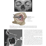 Atlas of Oral and Maxillofacial Surgery - 2nd Edicion