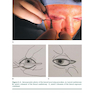 Facial Paralysis A Comprehensive Rehabilitative Approach