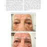 Facial Paralysis A Comprehensive Rehabilitative Approach