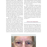 Facial Paralysis A Comprehensive Rehabilitative Approach