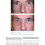 Facial Paralysis A Comprehensive Rehabilitative Approach