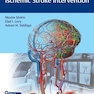 Video Atlas of Acute Ischemic Stroke Intervention