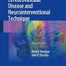 Handbook of Cerebrovascular Disease and Neurointerventional Technique