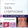 Skin Lymphoma The Illustrated Guide 5th Edition 2020