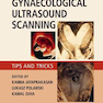 Gynaecological Ultrasound Scanning: Tips and Tricks 1st Edition 2020