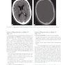 Lange Clinical Neurology and Neuroanatomy: A Localization-Based Approach2017  عصب شناسی بالینی: رویکردی مبتنی بر بومی سازی