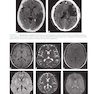 Lange Clinical Neurology and Neuroanatomy: A Localization-Based Approach2017  عصب شناسی بالینی: رویکردی مبتنی بر بومی سازی