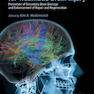 New Therapeutics for Traumatic Brain Injury, 1st Edition 2017