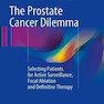 The Prostate Cancer Dilemma: Selecting Patients for Active Surveillance2016 معضل سرطان پروستات: انتخاب بیماران برای نظارت فعال