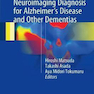 Neuroimaging Diagnosis for Alzheimer’s Disease and Other Dementias, 1st Edition2017