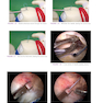 Gartsman’s Shoulder Arthroscopy 3rd Edition2018