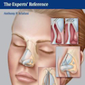 Rhinoplasty: The Experts’ Reference 1st Edition2015 جراحی زیبایی بینی: مرجع متخصصان