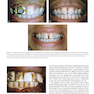 Ronald E. Goldstein’s Esthetics in Dentistry, 3rd Edition2018