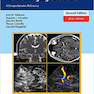 Neurosonology and Neuroimaging of Stroke, 2nd Edition2017 عصب شناسی و تصویربرداری عصبی از سکته مغزی