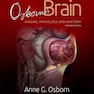 Osborn’s Brain, 2nd Edition2017 آزبورن مغز