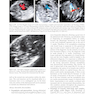 Ultrasound of Congenital Fetal Anomalies 2nd Edition2014