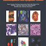 WHO Classification of Tumours of Haematopoietic and Lymphoid Tissues2017 طبقه بندی تومورهای بافتهای خون ساز و لنفاوی