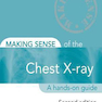 Making Sense of the Chest X-ray: A hands-on guide, 2nd Edition2013 ساختن حس اشعه ایکس قفسه سینه: یک راهنمای عملی